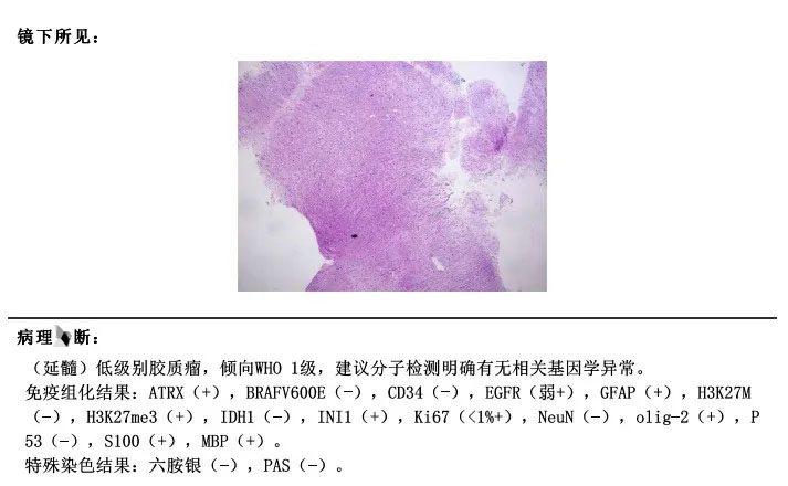 病理結果