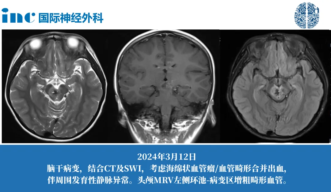 巴教授到國(guó)內(nèi)蘇州約的到他嗎——巴教授案例圖片