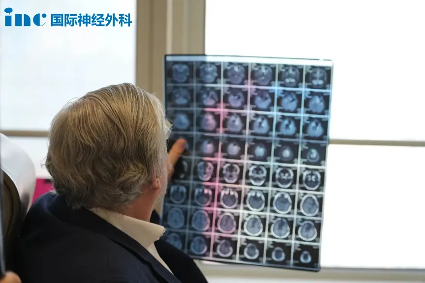 胚胎發(fā)育不良性神經上皮腫瘤DNET
