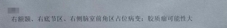 16歲男孩--基底節(jié)膠質(zhì)瘤