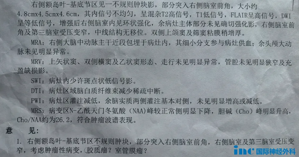 16歲男孩--基底節(jié)膠質(zhì)瘤