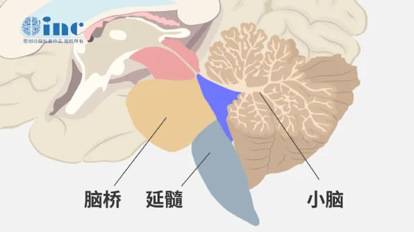 四腦室圖片