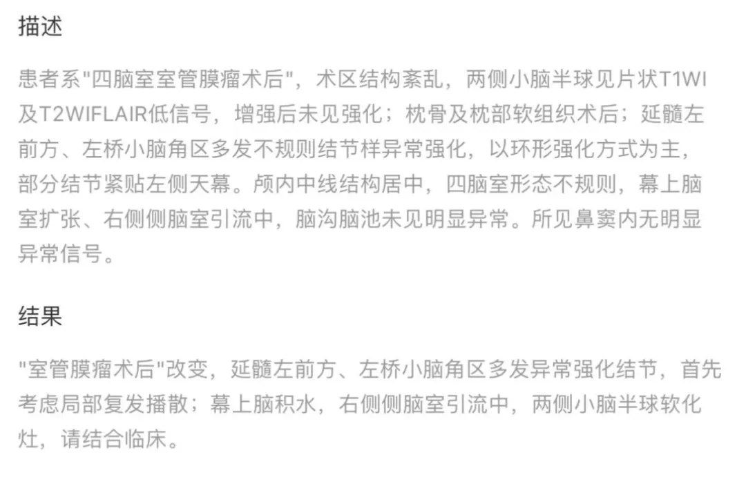 術(shù)后半年核磁影像復(fù)查提示復(fù)發(fā)