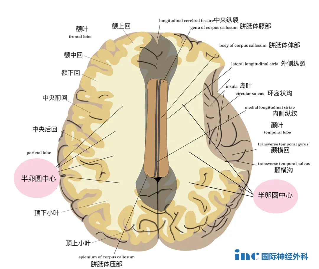 功能區(qū)海綿狀血管瘤手術(shù)