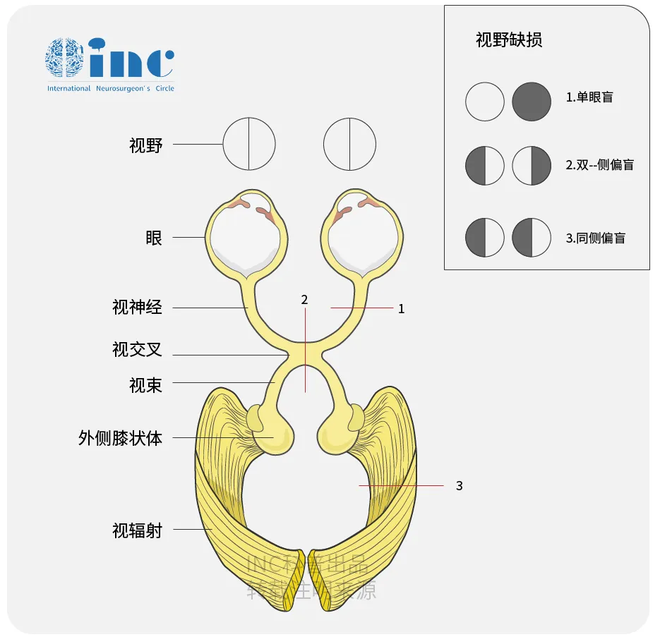 視神經(jīng)科普?qǐng)D片