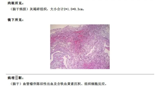 術后患者MRI顯示面丘結構恢復