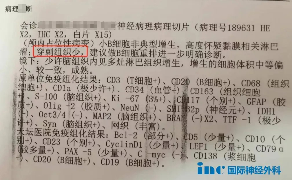 活檢結(jié)果
