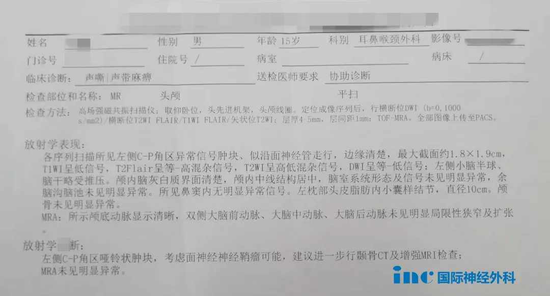 頸靜脈孔區(qū)腫瘤
