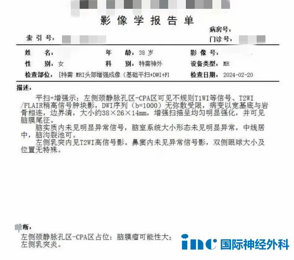 39歲女性-頸靜脈孔區(qū)腦膜瘤報(bào)告單圖片
