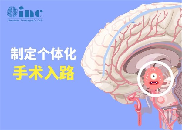 顱咽管瘤手術(shù)應(yīng)該開顱還是經(jīng)鼻?