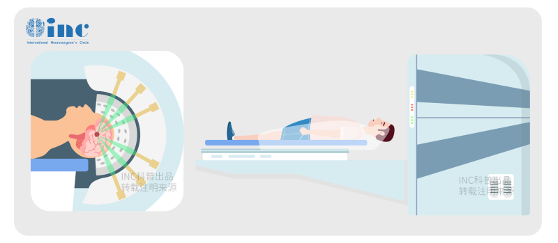 三叉神經(jīng)鞘瘤手術(shù)后有哪些后遺癥?