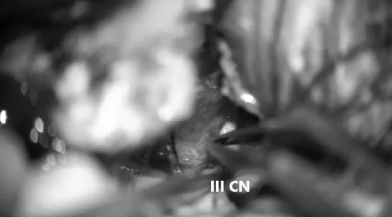三腦神經(jīng)的識(shí)別