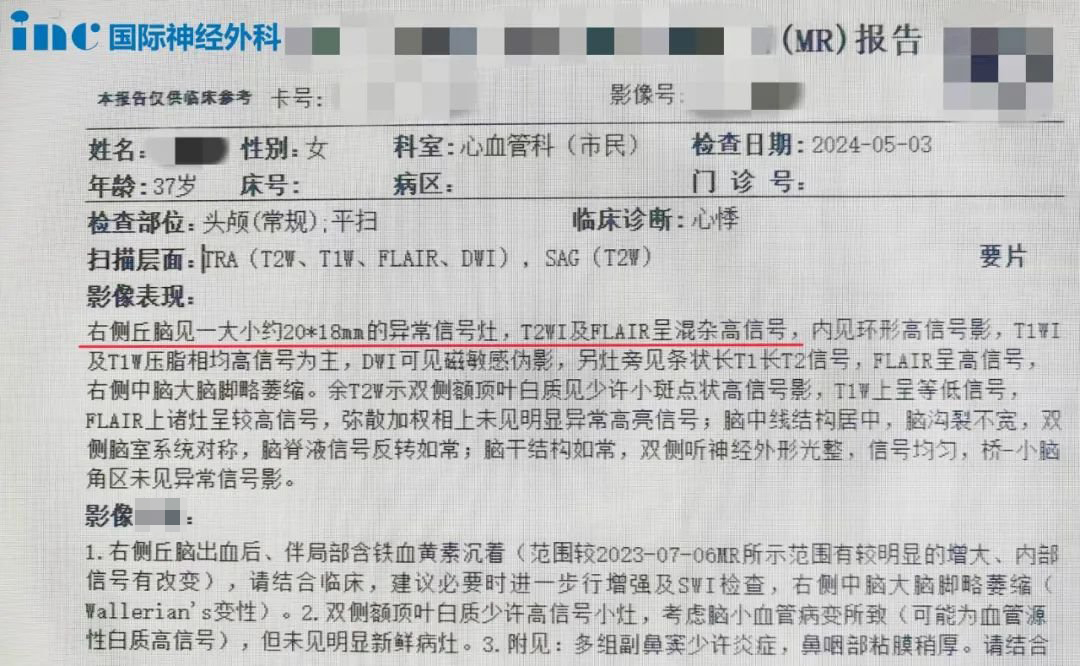 海綿狀血管瘤