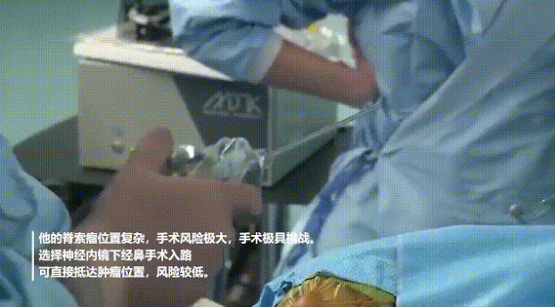 為病人選擇了神經(jīng)內(nèi)鏡下經(jīng)鼻手術(shù)入路可直接抵達(dá)腫瘤位置，風(fēng)險(xiǎn)較低。