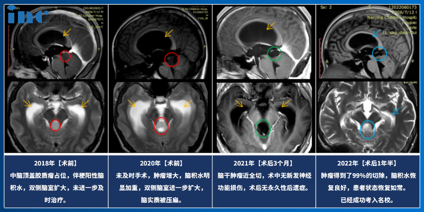 點擊術前影像，閱讀完整患者故事