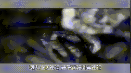 手術(shù)過程
