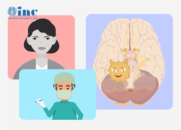 腦干膠質(zhì)瘤活檢方法是什么?活檢成功率高嗎?