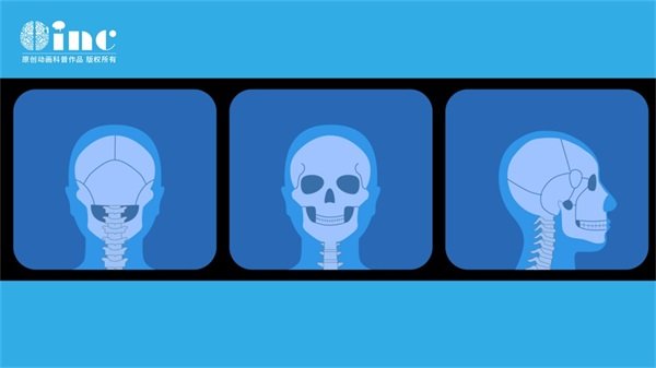 室管膜瘤三級會一直復(fù)發(fā)嗎？什么程度會死亡？