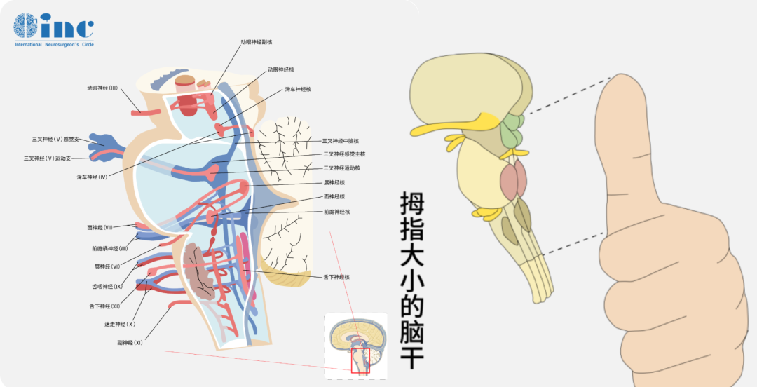 腦干是人的生命中樞，包括中腦、腦橋、延髓，腦干海綿狀血管瘤會導致腦干出血，使病人出現(xiàn)肢體癱瘓、昏迷，甚至危及生命。