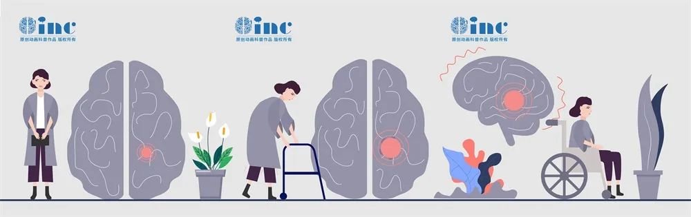 腦干占位(如腫瘤、出血或膿腫)在神經(jīng)外科是非常嚴重的情況，可以壓迫或破壞腦干的正常結構和功能，除了各種顱神經(jīng)損傷(如肢體無力、麻木、視力下降、面癱等)，還可以導致急性重癥風險