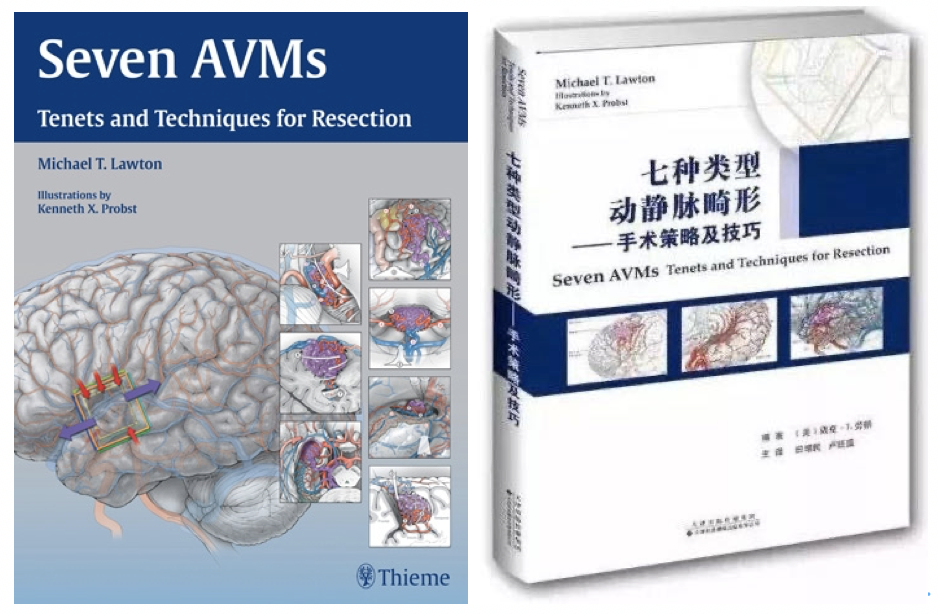 《SEVEN AVMs》