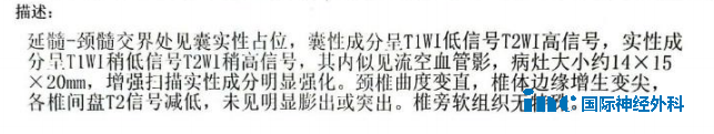 延頸髓交接處有占位