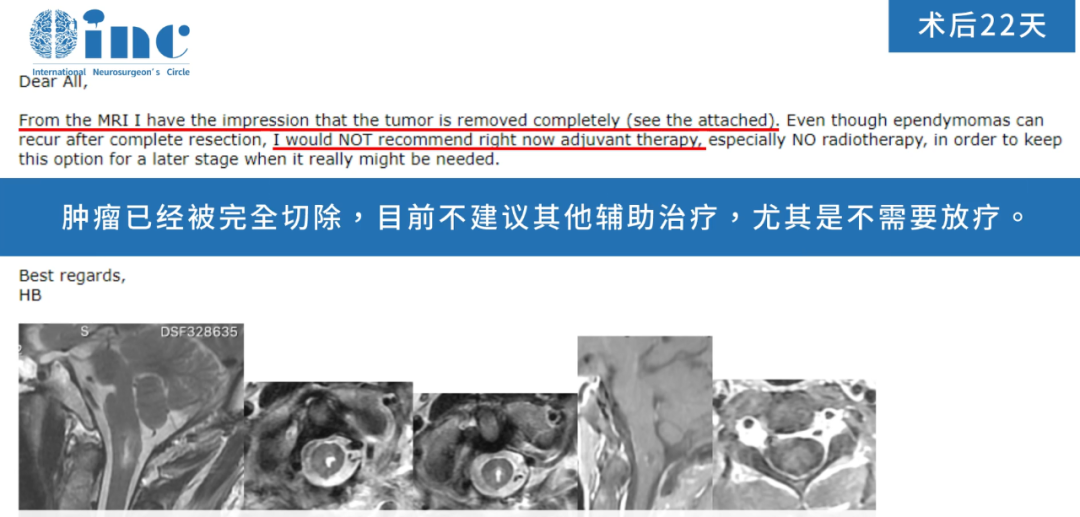 術(shù)后22天，巴教授在收到最新復(fù)查影像后為患者評估并郵件回復(fù)