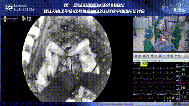 保證充分的骨瓣骨窗暴露是入路的關(guān)鍵，根據(jù)術(shù)中病灶的情況隨時(shí)彌補(bǔ)骨窗暴露的不足，以達(dá)到更好的術(shù)野暴露。