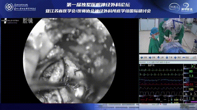 繼續(xù)分離腫瘤和腦組織，注意避免出血，在切除病變過(guò)程中注意鈍性分離、避免使用雙極電凝損傷脊髓。