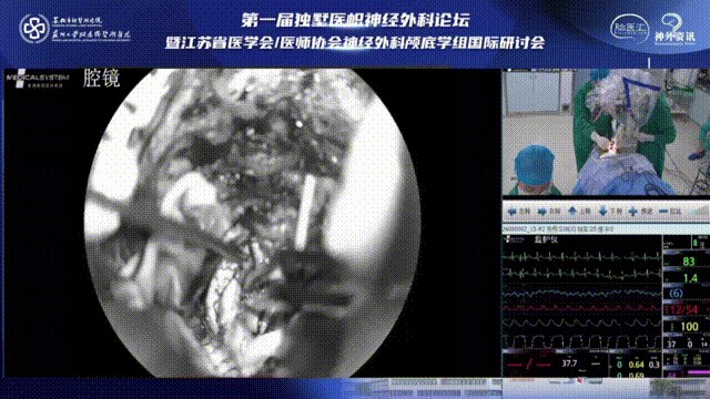 瘤腔、術(shù)野止血，水密縫合腦膜，關(guān)顱，患者全程呼吸、心跳平穩(wěn)，手術(shù)順利。