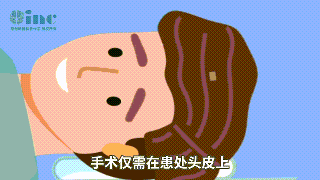 激光間質(zhì)熱療（LITT）