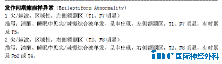 癲癇