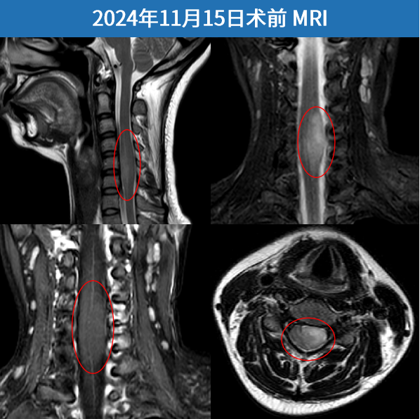 術前MRI