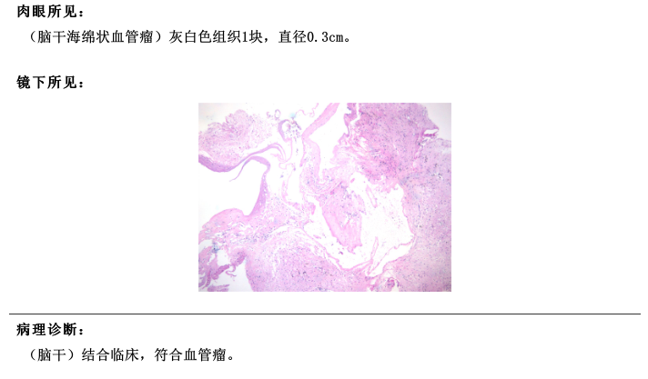 術(shù)后病理