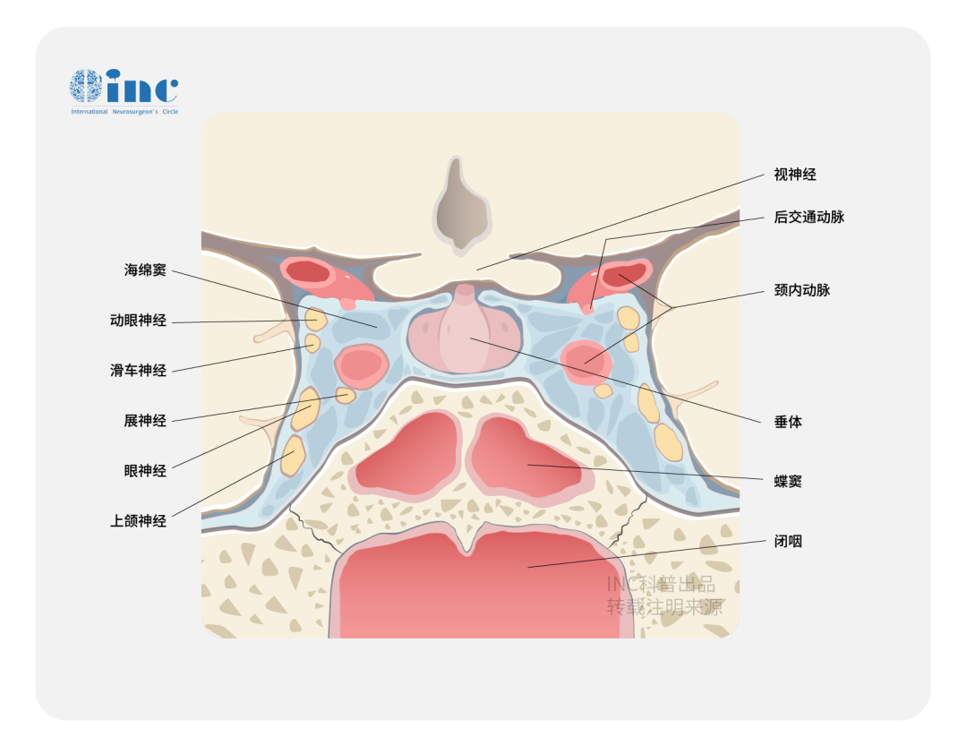 視路膠質(zhì)瘤起源于視神經(jīng)、視交叉、視束或下丘腦等關(guān)鍵部位，這些區(qū)域不僅結(jié)構(gòu)復(fù)雜，而且富含神經(jīng)纖維和血管。