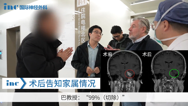 手術(shù)室外，結(jié)束手術(shù)后的巴教授第一時(shí)間內(nèi)將這個(gè)好消息告訴了一直守護(hù)在外的方女士家人。