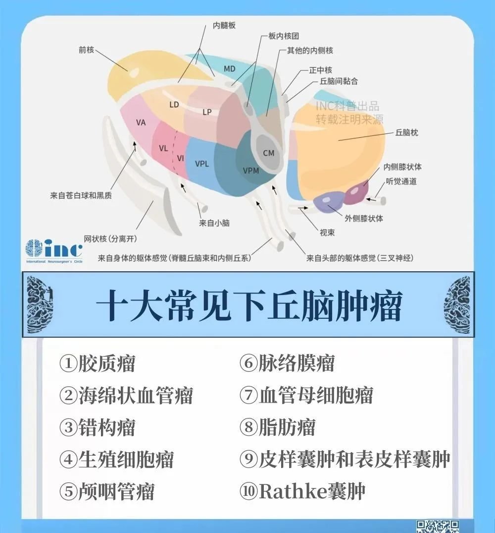 丘<a href='/naoliu/' target='_blank'><u>腦腫瘤</u></a>