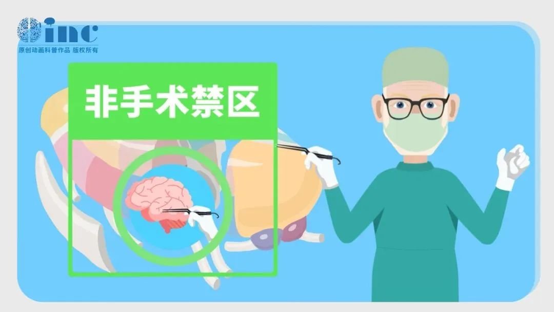 James T. Rutka教授尤其擅長(zhǎng)兒童丘腦膠質(zhì)瘤患者的個(gè)性化綜合治療，在他看來(lái)，丘腦不再是手術(shù)的“禁區(qū)”，而是需要勇氣和能力的“戰(zhàn)區(qū)”。