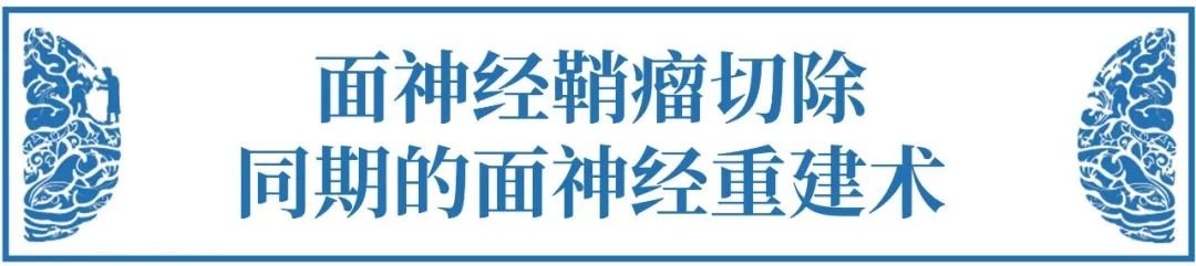 對于面神經(jīng)鞘瘤患者，術(shù)中為了完整切除腫瘤，對面神經(jīng)的損傷一般難以避免，因此，多考慮同期或二期行面神經(jīng)重建術(shù)。