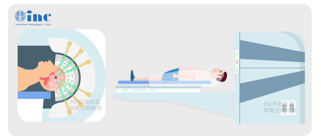 EANS工作組推薦，在以下情況下，只要與視神經(jīng)（ON）的距離超過3毫米，應(yīng)考慮采用(單次劑量或分割)SRS或SRT(C級(jí)):
