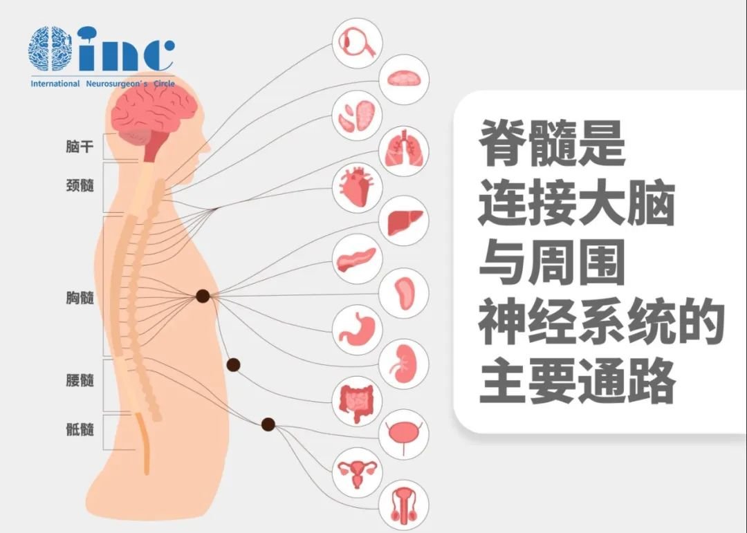 通俗來(lái)說(shuō)，如果小腦扁桃體進(jìn)入頸椎管內(nèi)，就會(huì)造成擁擠，類似于公路上的堵車甚至撞車，導(dǎo)致患者因脊髓神經(jīng)壓迫和腦脊液循環(huán)不暢，出現(xiàn)壓迫癥狀和脊髓空洞。