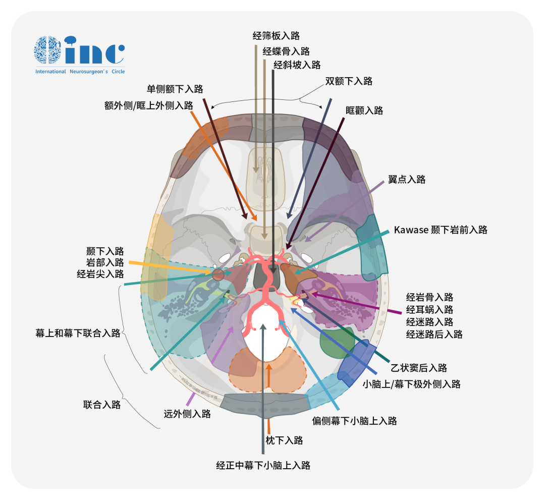 兒童前顱窩手術(shù)入路