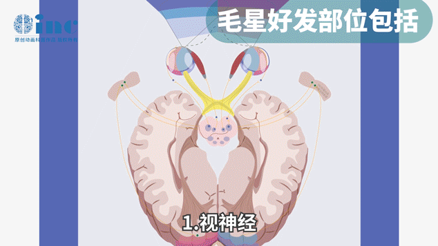 發(fā)病特征