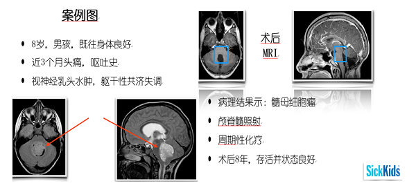 案例圖