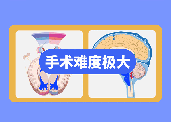 毛細(xì)胞型星形細(xì)胞瘤