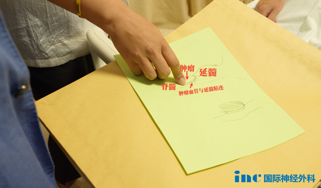 巴教授用圖紙演示著腫瘤和延髓和脊髓等重要腦結(jié)構(gòu)的關系