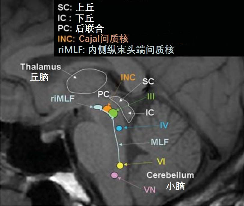 圖：中腦為人體重要的神經(jīng)核團(tuán)