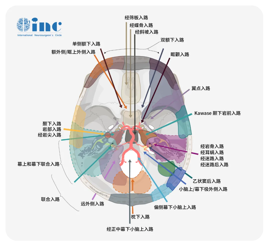 手術(shù)入路