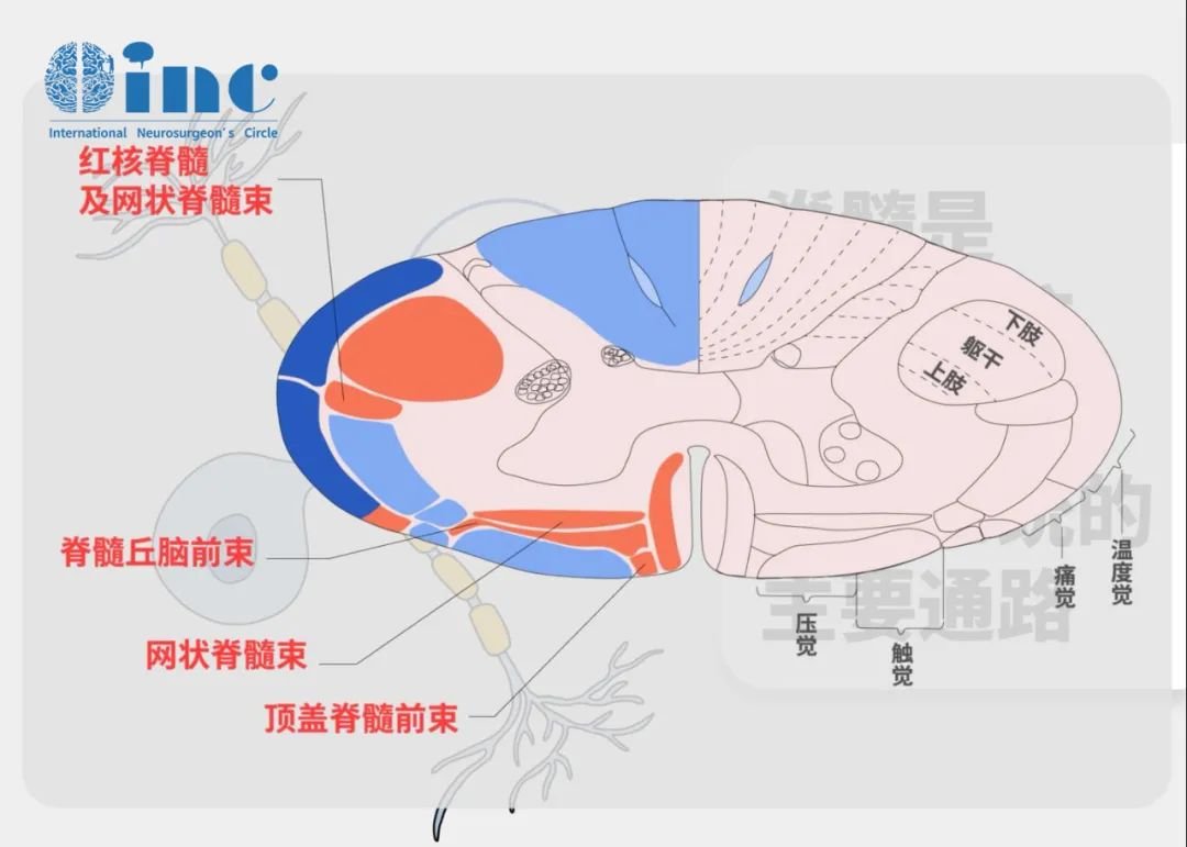 脊髓腫瘤分型有哪些？INC國際施羅德教授治療實例分享