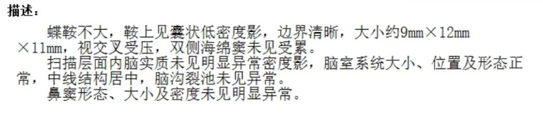 趙女士的檢查報告